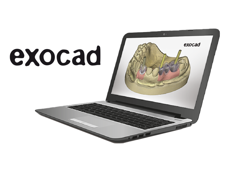 TBR Dental – Exocad