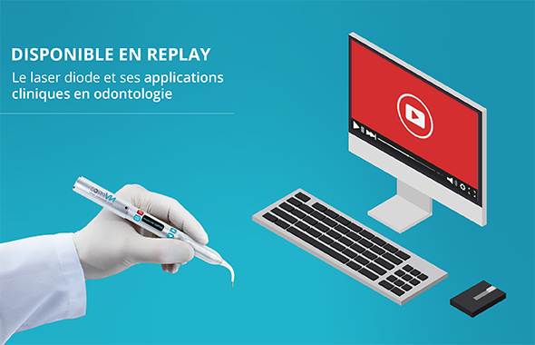 laser replay FR